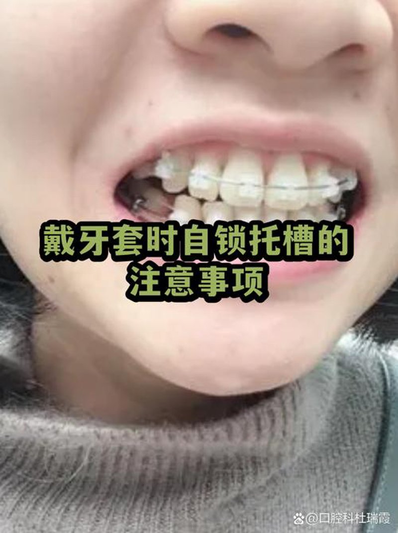 口腔正畸