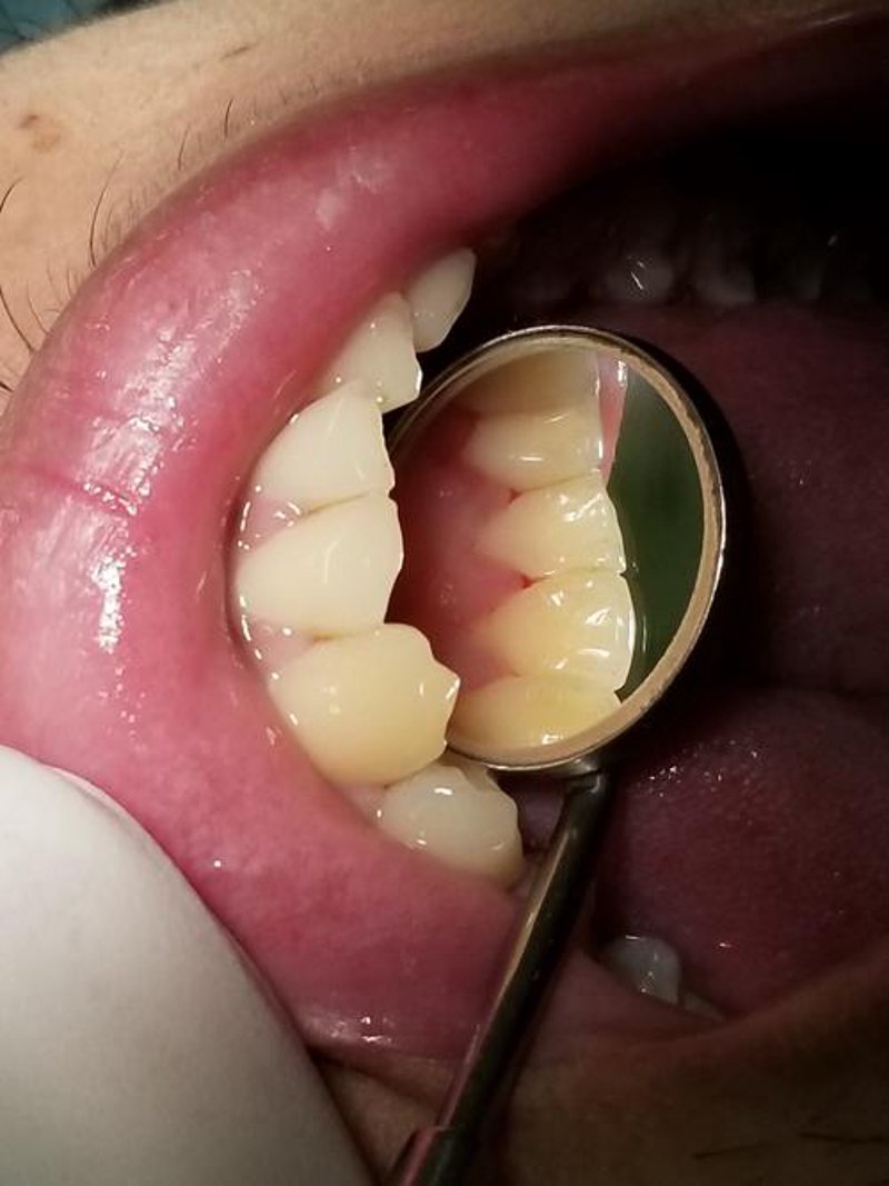 昭阳区牙科诊所：守护口腔健康的温馨港湾