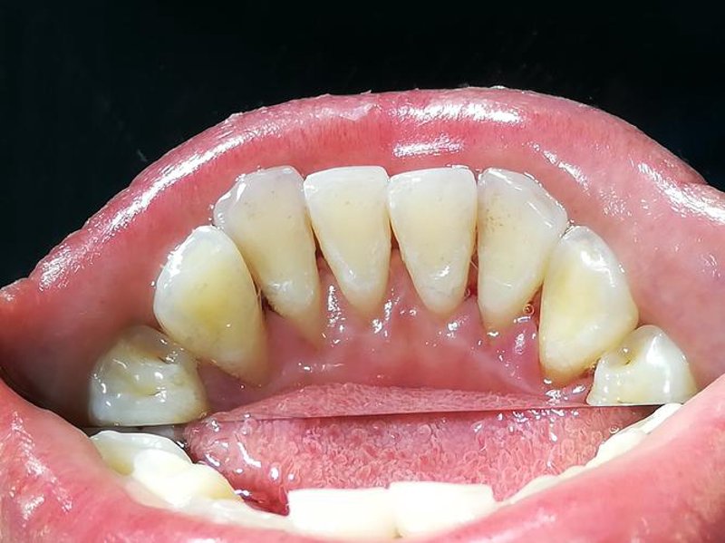 昭通牙科：守护口腔健康的新风向
